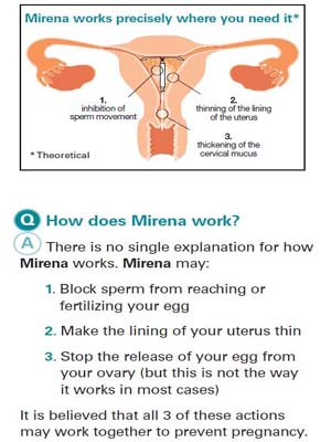 Can You Get A False Negative Pregnancy Test With Iud False Negative Pregnancy Test With Mirena Mothers Haven